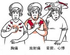 冠心病有哪些癥狀？
