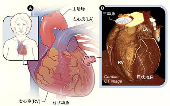 冠心病需要做哪些檢查？(圖2)