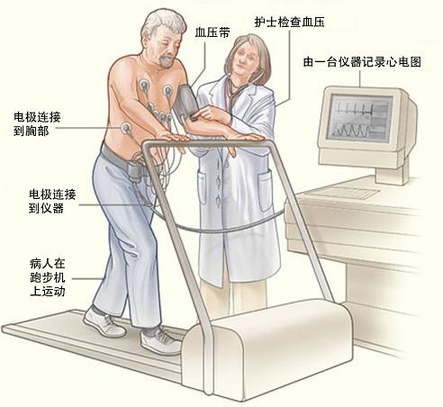冠心病需要做哪些檢查？(圖3)